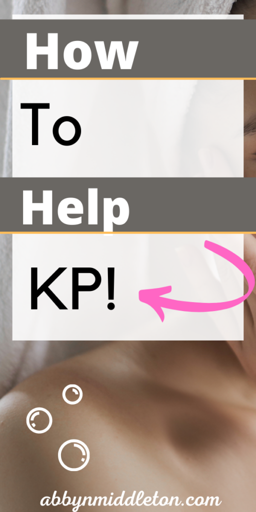 How to help KP!